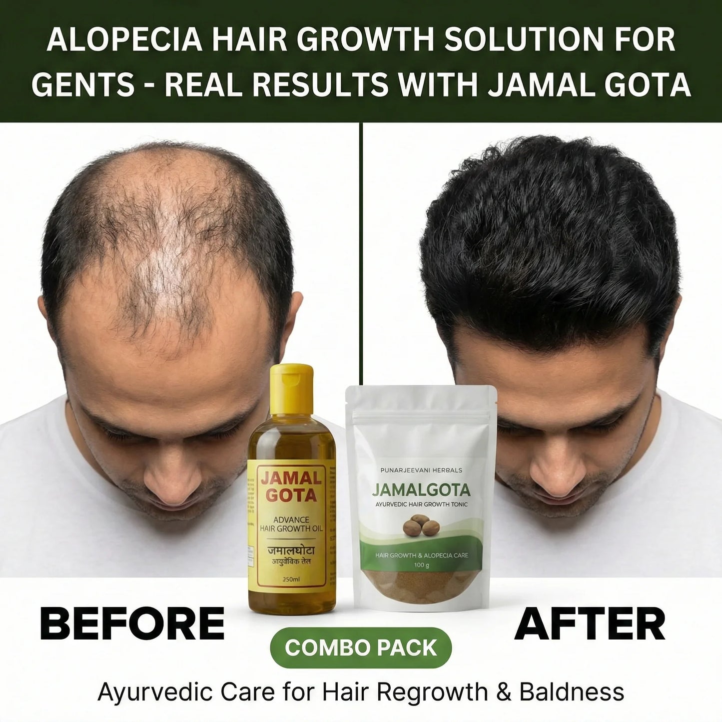 Advanced Jamalgota Herbal Hair Oil With Powder-100% Intense Hair Care