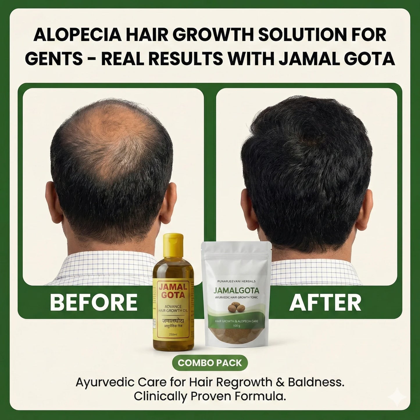Advanced Jamalgota Herbal Hair Oil With Powder-100% Intense Hair Care